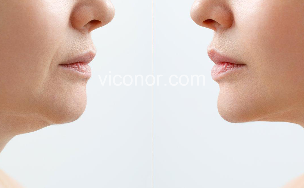 Viconor Infrared light therapy | 660nm&850nm Red Light Therapy for Face and Body