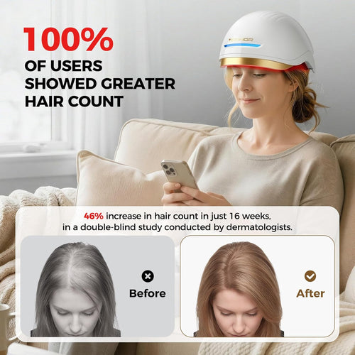 Viconor Infrared light therapy | for Hair Growth, FDA Cleared Hair Loss, 272 Lasers & LEDs.Treatment Options for Male and Female Hair Loss