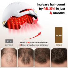 Load image into Gallery viewer, Viconor Infrared light therapy | for Hair Growth, FDA Cleared Hair Loss, 272 Lasers &amp; LEDs.Treatment Options for Male and Female Hair Loss