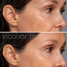 Load image into Gallery viewer, Viconor Infrared light therapy | 660nm&amp;850nm Red Light Therapy for Face and Body