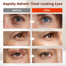 Load image into Gallery viewer, Viconor Infrared light therapy | Red Light Therapy for Eyes, No Light Leakage Under Eye Red Light Therapy